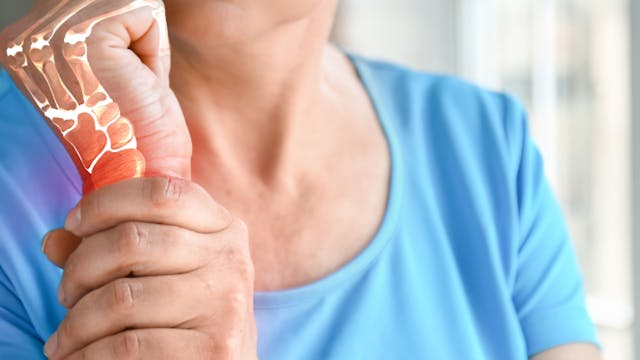 Osteoporose