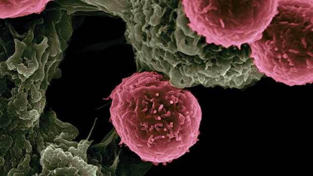 particle-based vaccines for cancer therapy