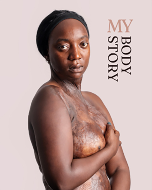 My body, my story 01