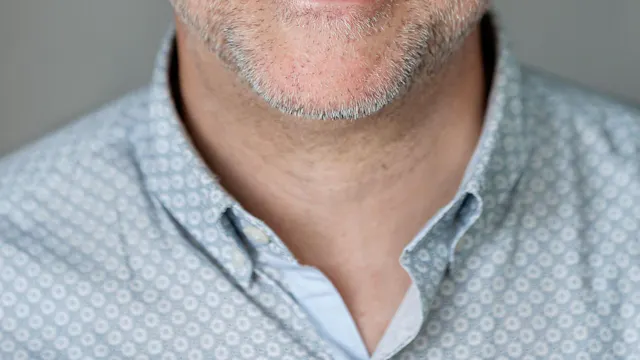 professor Johan Verberckmoes